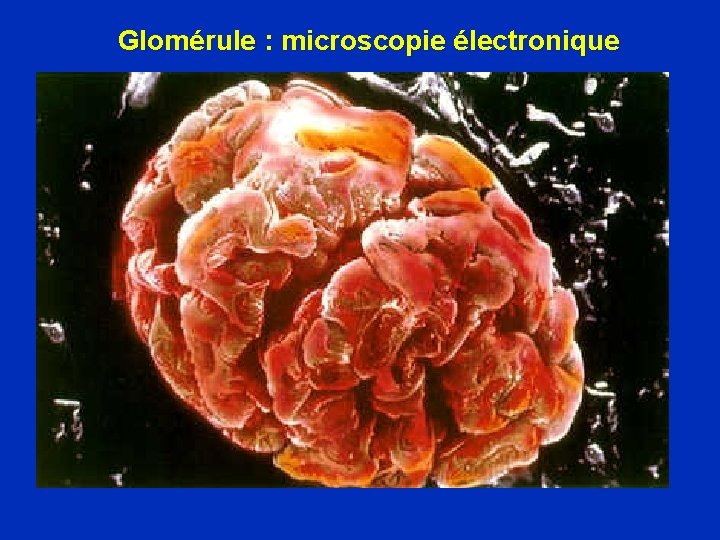 Glomérule : microscopie électronique 