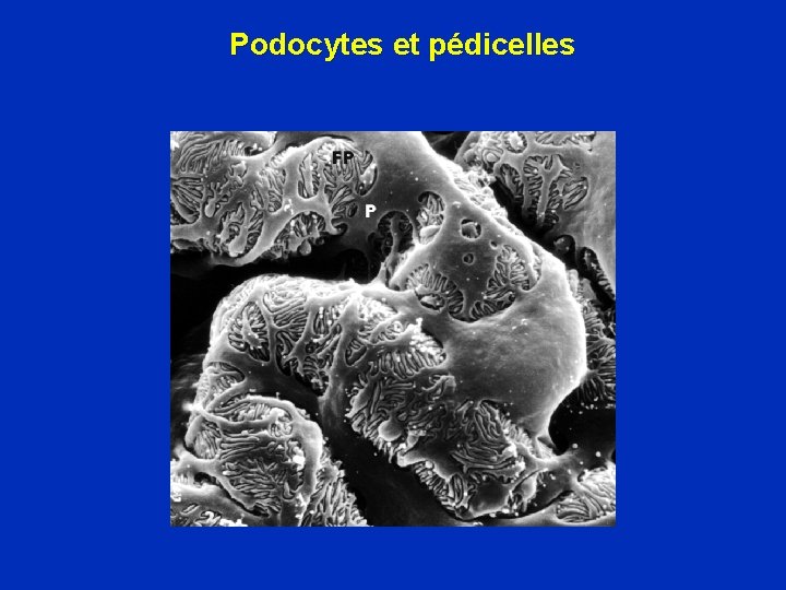 Podocytes et pédicelles 