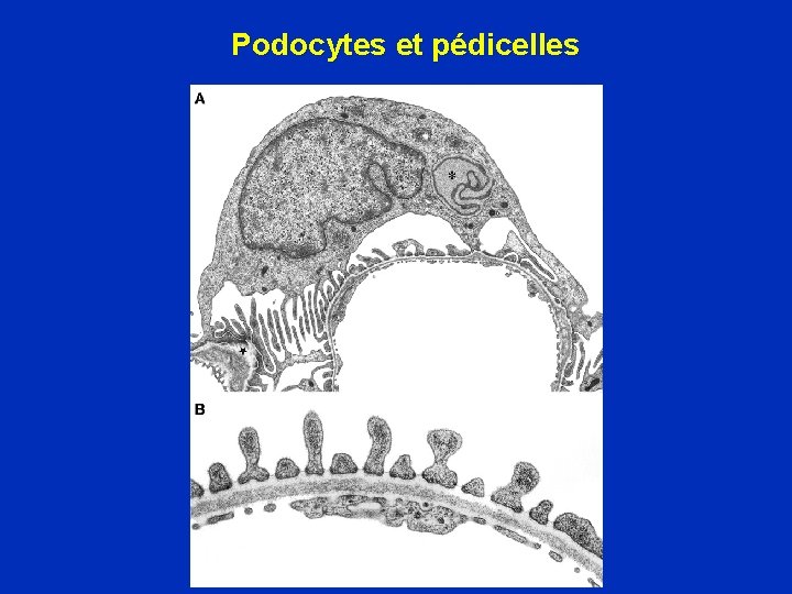 Podocytes et pédicelles 