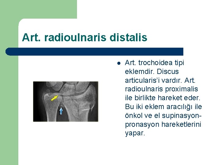 Art. radioulnaris distalis l Art. trochoidea tipi eklemdir. Discus articularis’i vardır. Art. radioulnaris proximalis