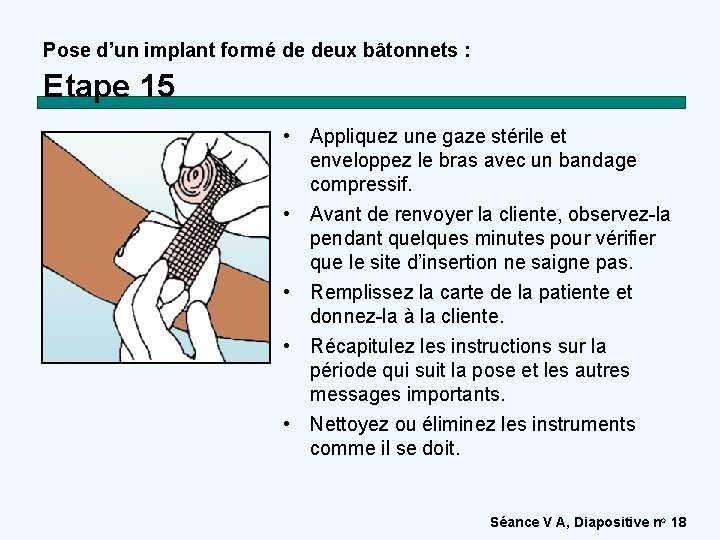 Pose d’un implant formé de deux bâtonnets : Etape 15 • Appliquez une gaze