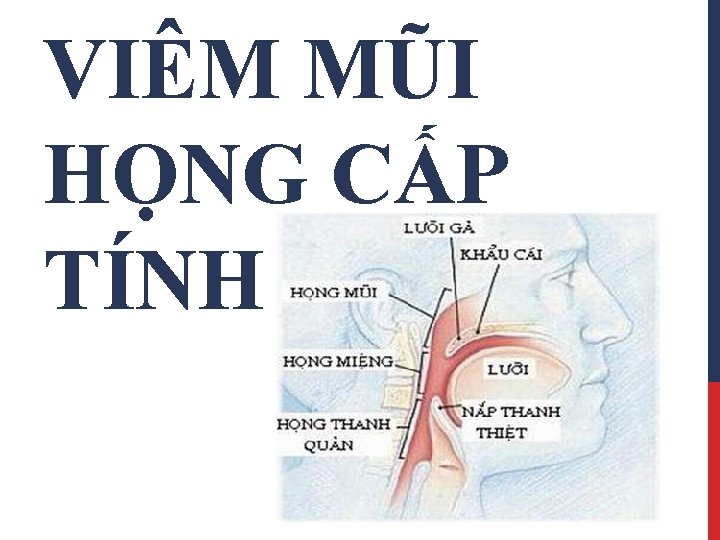 VIÊM MŨI HỌNG CẤP TÍNH 
