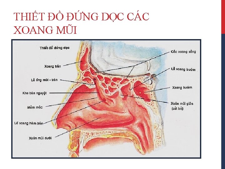 THIẾT ĐỒ ĐỨNG DỌC CÁC XOANG MŨI 