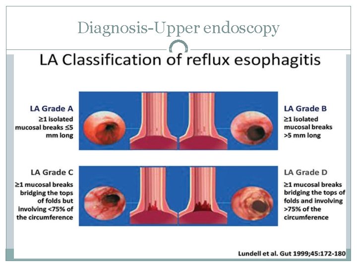 Diagnosis Upper endoscopy 