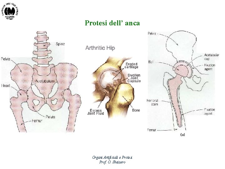 Protesi dell’ anca Organi Artificiali e Protesi Prof. O. Sbaizero 