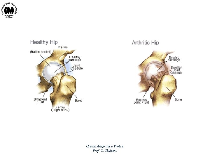 Organi Artificiali e Protesi Prof. O. Sbaizero 