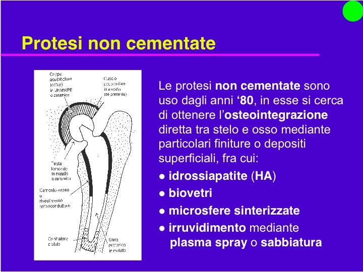 Organi Artificiali e Protesi Prof. O. Sbaizero 