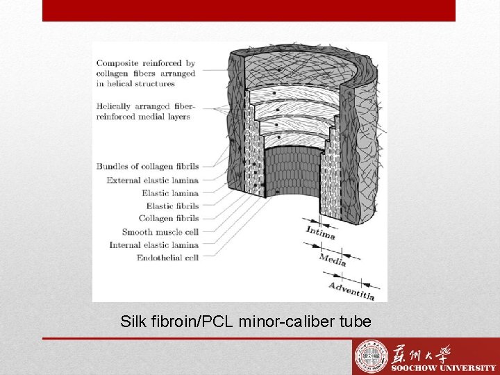 Silk fibroin/PCL minor-caliber tube 