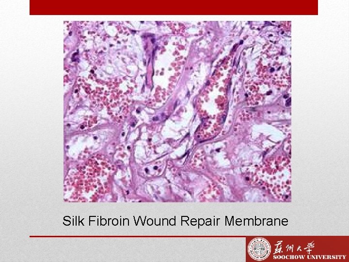 Silk Fibroin Wound Repair Membrane 