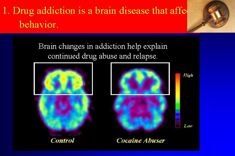 1. Drug addiction is a brain disease that affects behavior. Brain changes in addiction