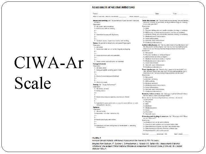 CIWA-Ar Scale CIWA-Ar Scale