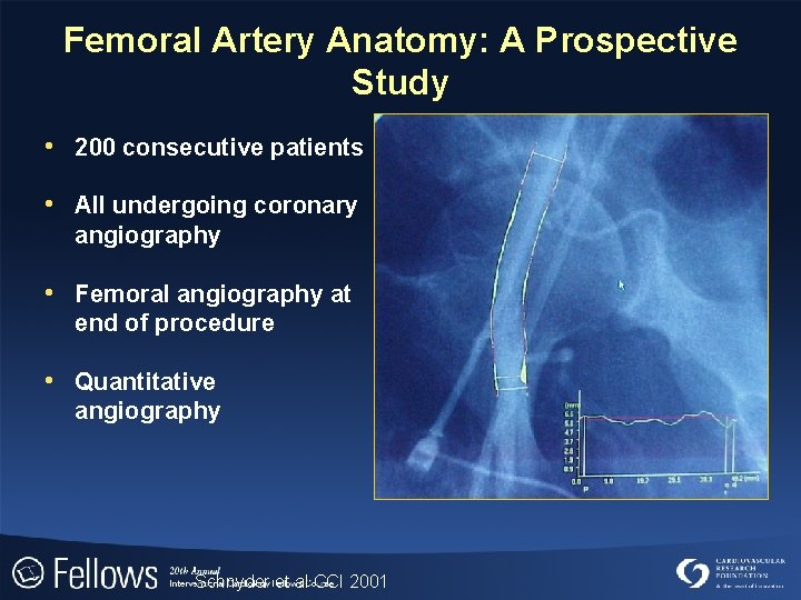 Femoral Artery Anatomy: A Prospective Study • 200 consecutive patients • All undergoing coronary