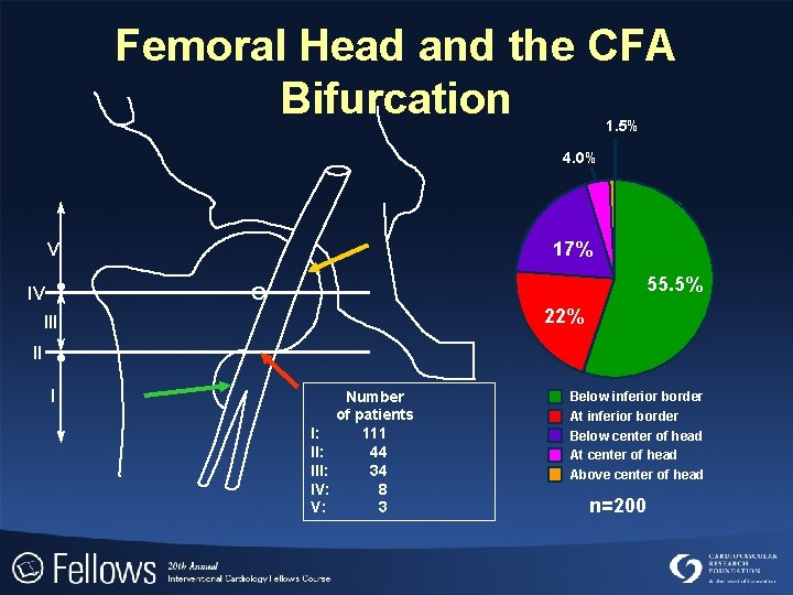 Femoral Head and the CFA Bifurcation 1. 5% 4. 0% 17% V 55. 5%