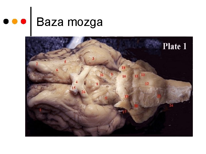 Baza mozga 