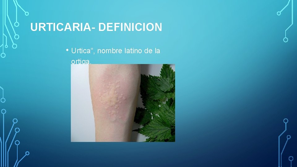 URTICARIA- DEFINICION • Urtica”, nombre latino de la ortiga. URTICARIA- DEFINICION • Urtica”, nombre latino de la ortiga.