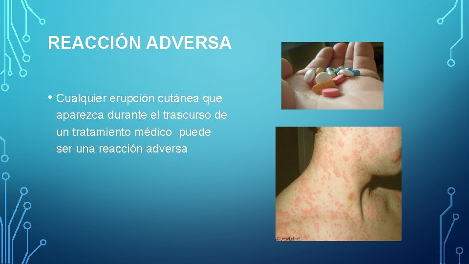 REACCIÓN ADVERSA • Cualquier erupción cutánea que aparezca durante el trascurso de un tratamiento REACCIÓN ADVERSA • Cualquier erupción cutánea que aparezca durante el trascurso de un tratamiento
