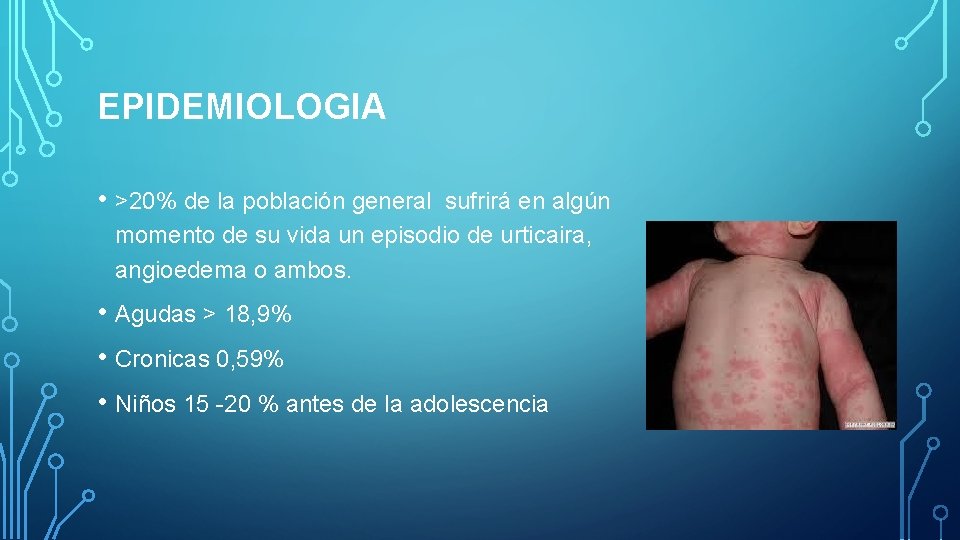 EPIDEMIOLOGIA • >20% de la población general sufrirá en algún momento de su vida EPIDEMIOLOGIA • >20% de la población general sufrirá en algún momento de su vida