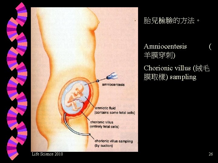胎兒檢驗的方法。 Amniocentesis 羊膜穿刺) ( Chorionic villus (絨毛 膜取樣) sampling Life Science 2010 26 