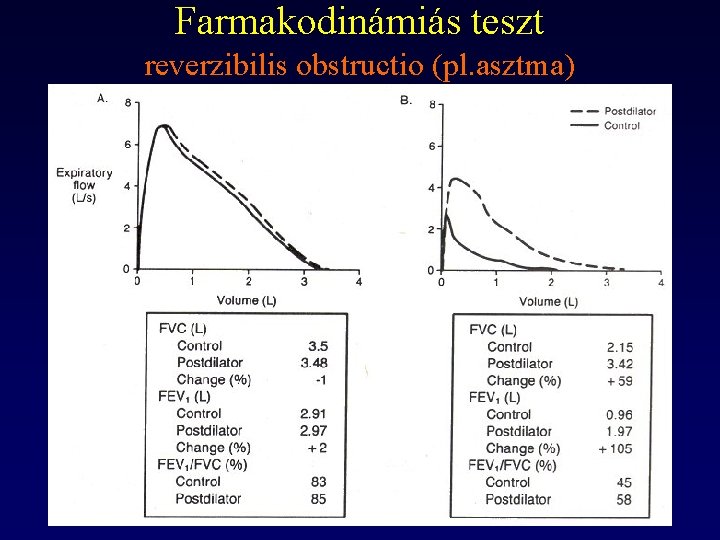 Farmakodinámiás teszt reverzibilis obstructio (pl. asztma) 