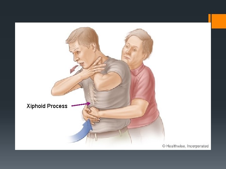 Xiphoid Process 