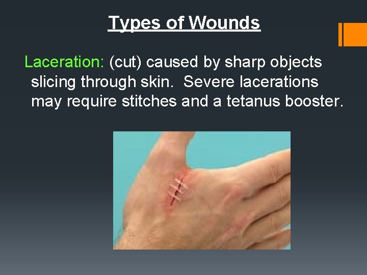 Types of Wounds Laceration: (cut) caused by sharp objects slicing through skin. Severe lacerations