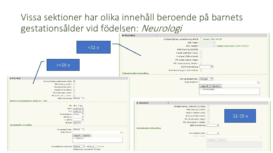 Vissa sektioner har olika innehåll beroende på barnets gestationsålder vid födelsen: Neurologi <32 v