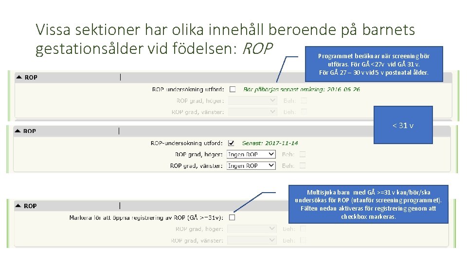 Vissa sektioner har olika innehåll beroende på barnets gestationsålder vid födelsen: ROP Programmet beräknar