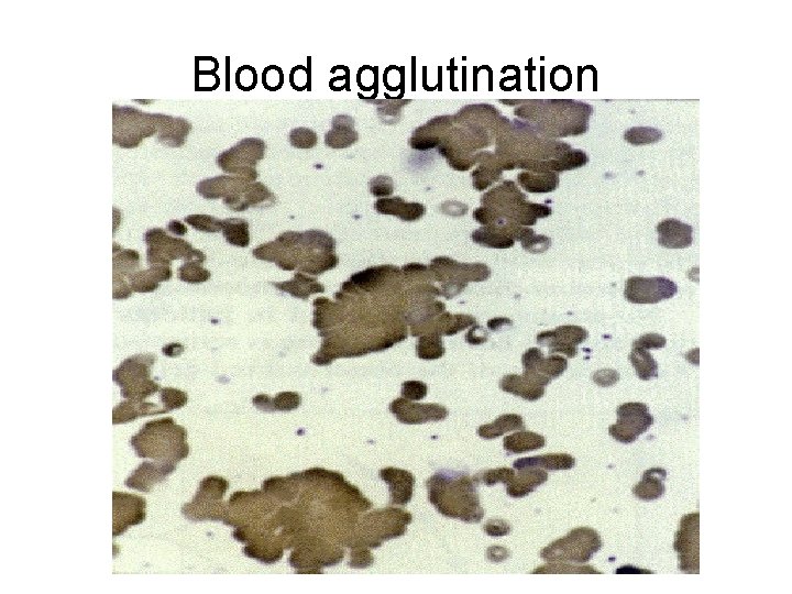 Blood agglutination 