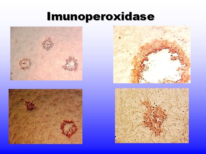 Imunoperoxidase 
