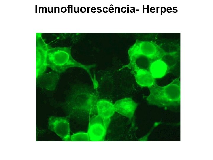 Imunofluorescência- Herpes 