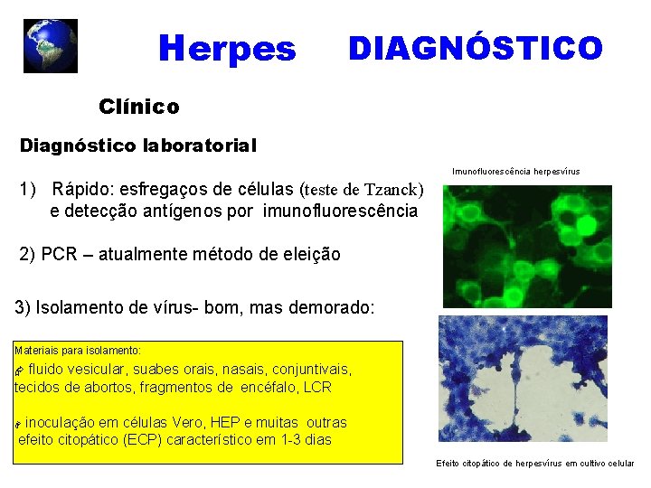 Herpes DIAGNÓSTICO Clínico Diagnóstico laboratorial Imunofluorescência herpesvírus 1) Rápido: esfregaços de células (teste de