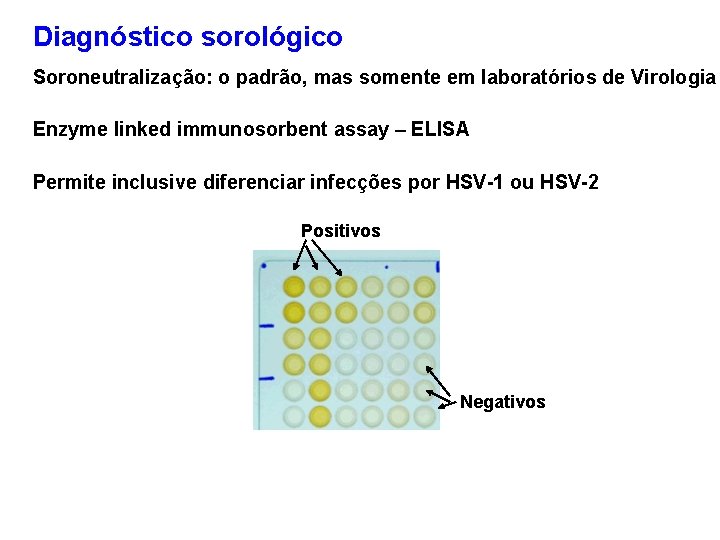 Diagnóstico sorológico Soroneutralização: o padrão, mas somente em laboratórios de Virologia Enzyme linked immunosorbent
