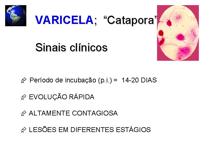 VARICELA; “Catapora” Sinais clínicos Período de incubação (p. i. ) = 14 -20 DIAS