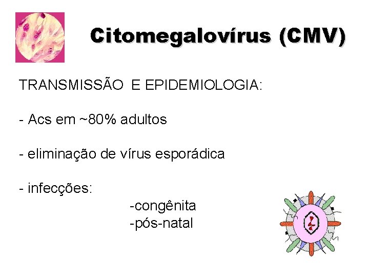 Citomegalovírus (CMV) TRANSMISSÃO E EPIDEMIOLOGIA: - Acs em ~80% adultos - eliminação de vírus