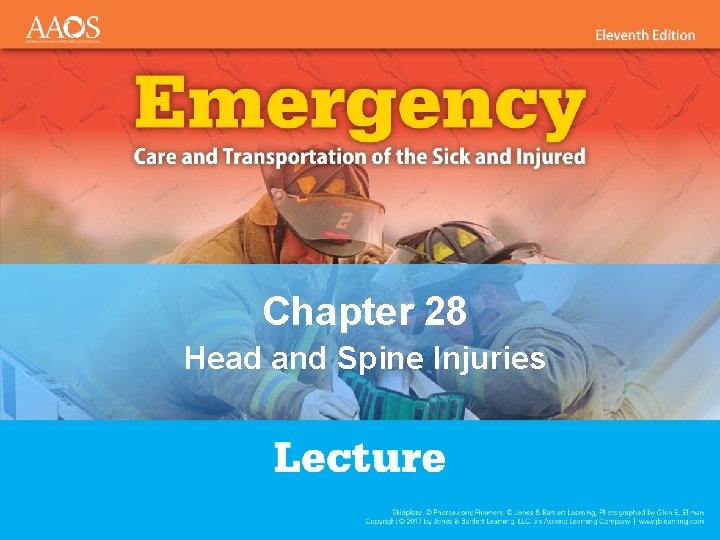 Chapter 28 Head and Spine Injuries 