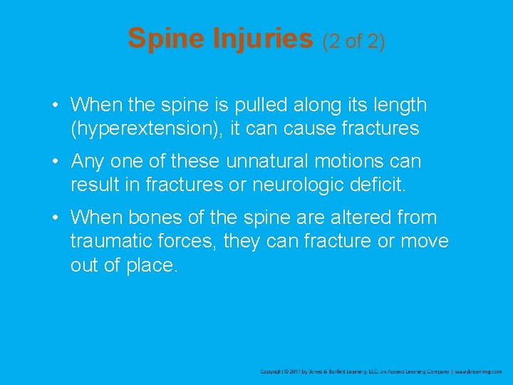 Spine Injuries (2 of 2) • When the spine is pulled along its length