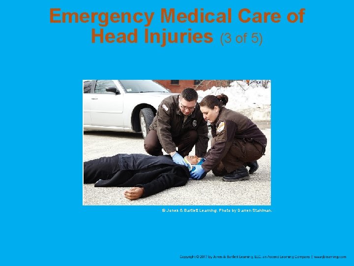 Emergency Medical Care of Head Injuries (3 of 5) © Jones & Bartlett Learning.