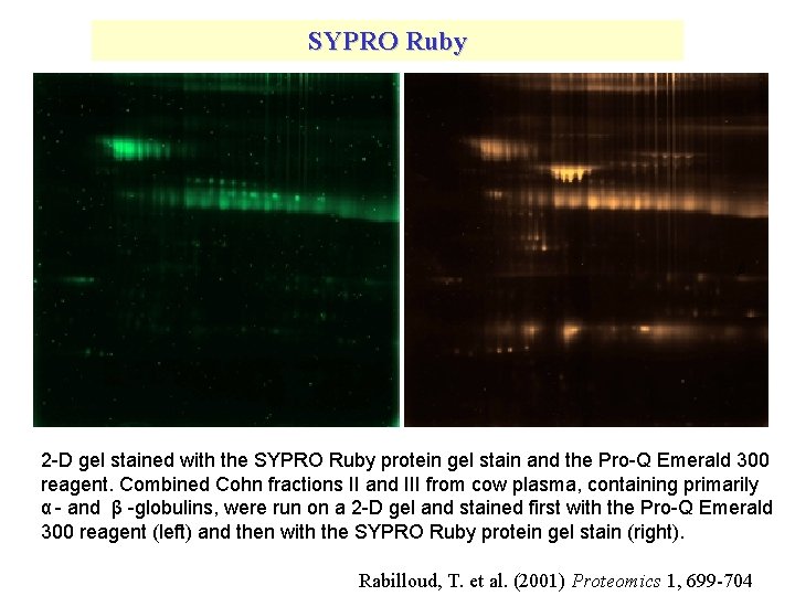 SYPRO Ruby 2 -D gel stained with the SYPRO Ruby protein gel stain and