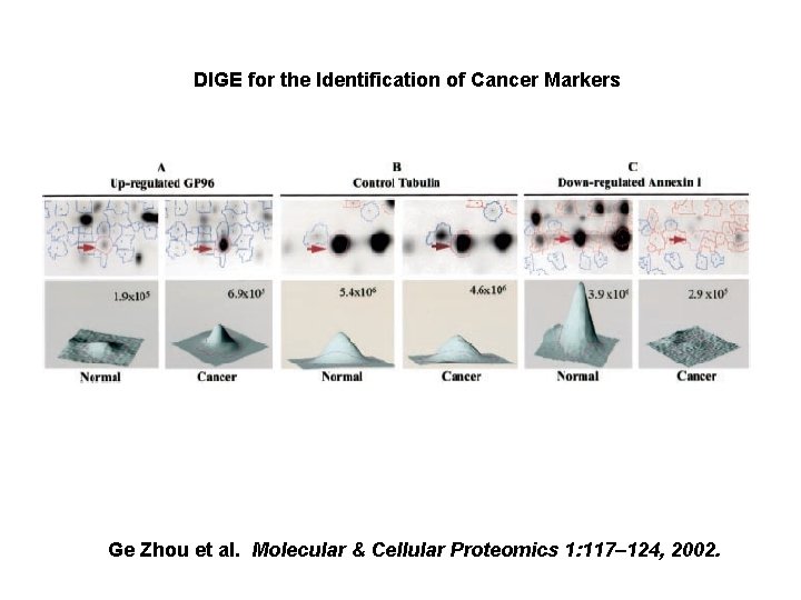 DIGE for the Identification of Cancer Markers Ge Zhou et al. Molecular & Cellular