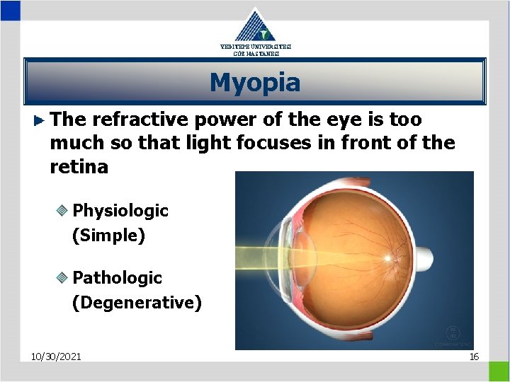 YEDİTEPE ÜNİVERSİTESİ GÖZ HASTANESİ Myopia The refractive power of the eye is too much