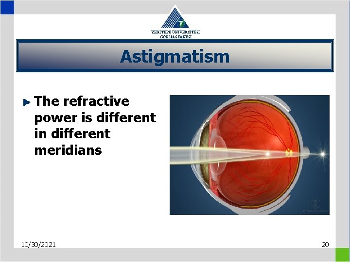 YEDİTEPE ÜNİVERSİTESİ GÖZ HASTANESİ Astigmatism The refractive power is different in different meridians 10/30/2021