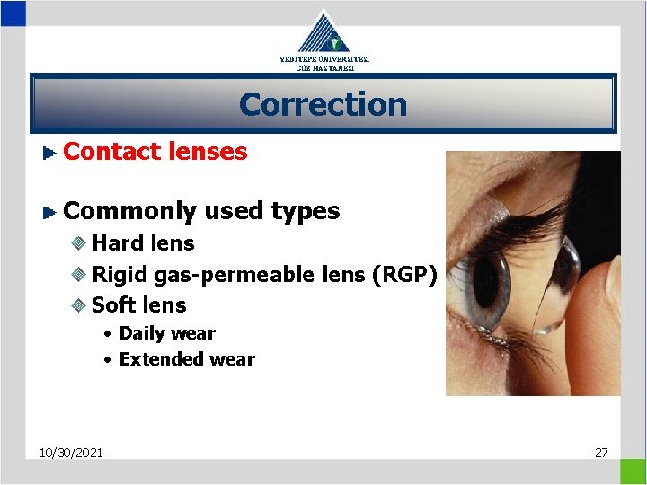 YEDİTEPE ÜNİVERSİTESİ GÖZ HASTANESİ Correction Contact lenses Commonly used types Hard lens Rigid gas-permeable