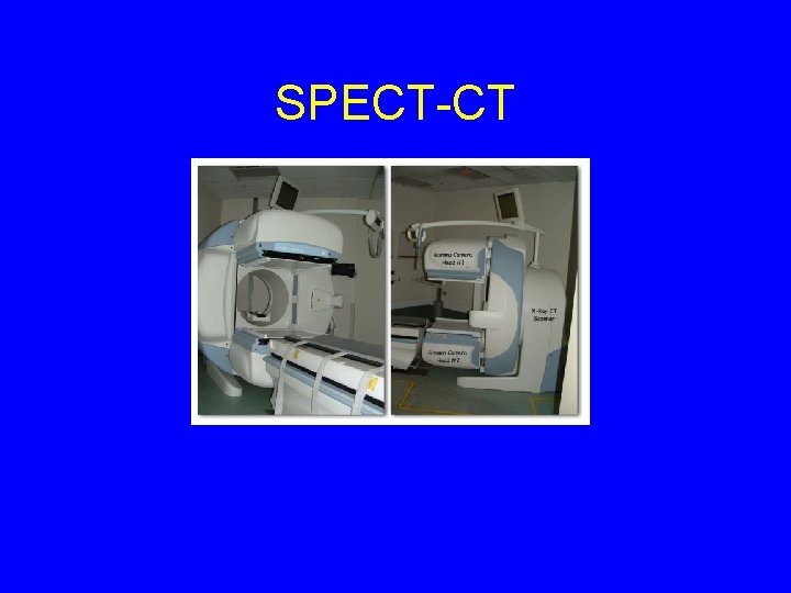 SPECT-CT 