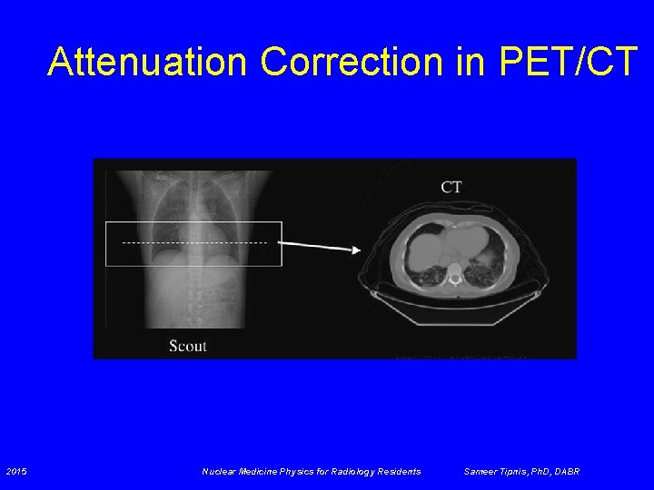 Attenuation Correction in PET/CT 2015 Nuclear Medicine Physics for Radiology Residents Sameer Tipnis, Ph.