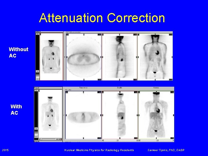 Attenuation Correction Without AC With AC 2015 Nuclear Medicine Physics for Radiology Residents Sameer