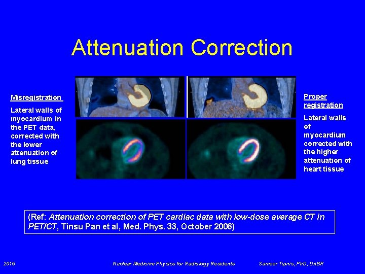 Attenuation Correction Proper registration Misregistration Lateral walls of myocardium in the PET data, corrected