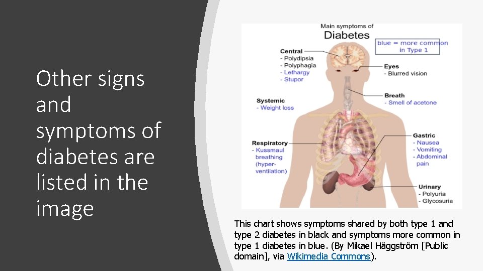 Other signs and symptoms of diabetes are listed in the image This chart shows