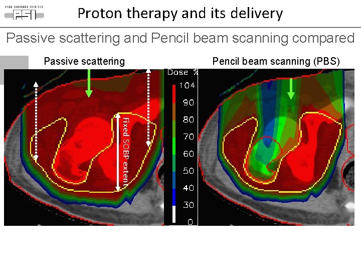 Proton therapy and its delivery Passive scattering and Pencil beam scanning compared Passive scattering Proton therapy and its delivery Passive scattering and Pencil beam scanning compared Passive scattering