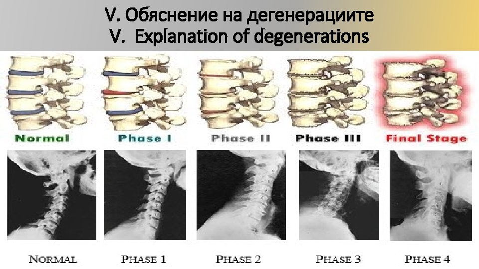V. Обяснение на дегенерациите V. Explanation of degenerations 