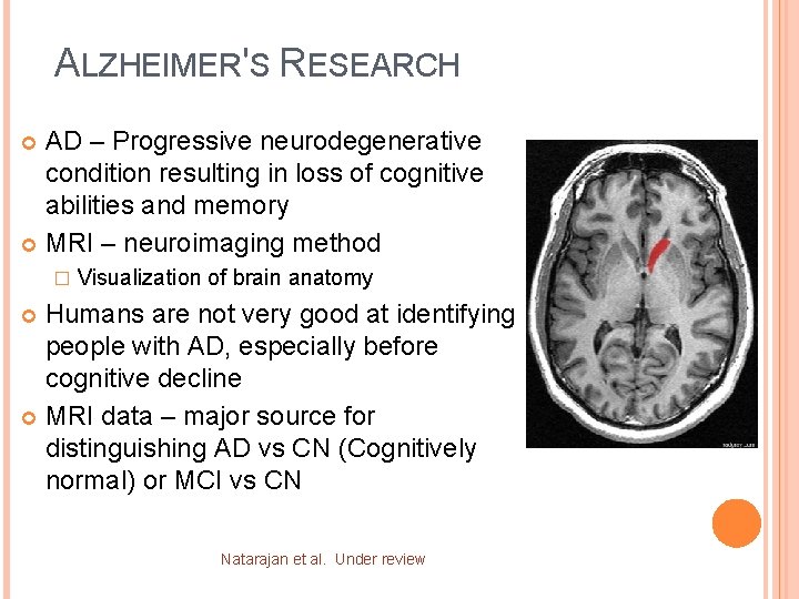 ALZHEIMER'S RESEARCH AD – Progressive neurodegenerative condition resulting in loss of cognitive abilities and